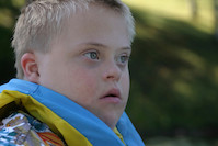 Downův syndrom